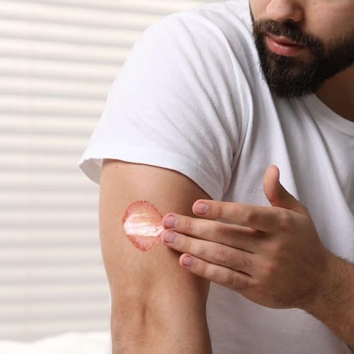 Side perspective of TenderGentle miconazole skin ointment highlighting the four ounce size.