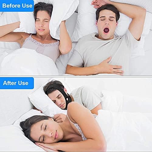 Imported USA quality anti snore chin strap for better sleep