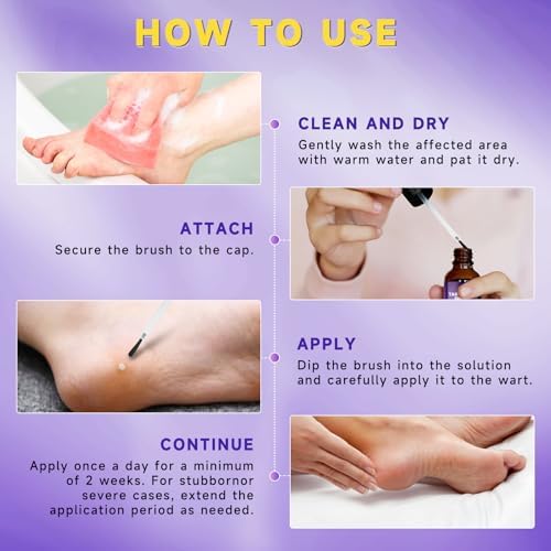 Authentic TTsiya imported skincare for common and flat wart removal