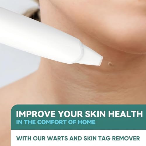Cryogenic skin tag remover kit with precision probes and needles.