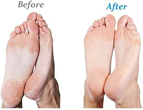 Authentic Emjoi Micro-Pedi Ultra packaging for professional foot care