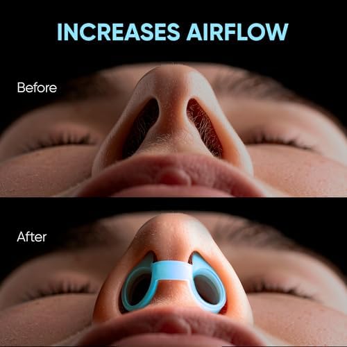 Full kit of 8 blue nasal vents for better nighttime breathing.