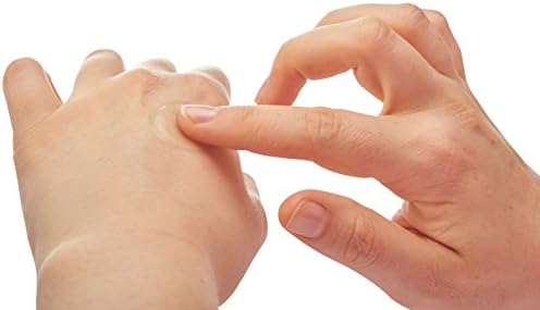 After Bite Xtra soothing sting treatment gel with baking soda and ammonia