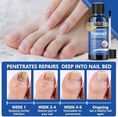 Professional nail fungus repair solution for healthy nail growth