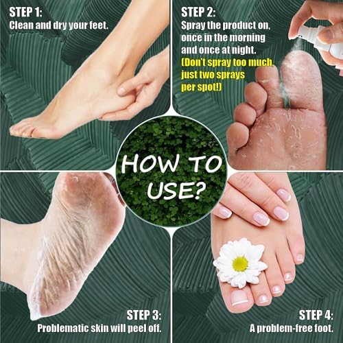 Imported Bujiola ginger spray being applied to clean feet.
