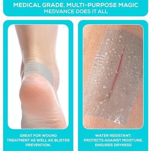 MedVance sensitive skin dressing tape being torn cleanly along its perforated grid.