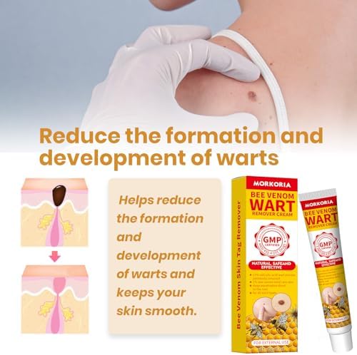 MORKORIA Salicylic Acid Wart Cream packaging showing 17 percent concentration.
