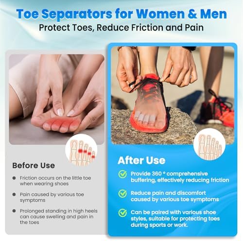 Pnrskter foot care products showing 20 count pack of small toe sleeves.
