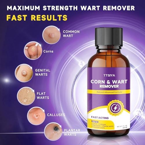 TTsiya fast acting wart removal liquid with precision brush applicator