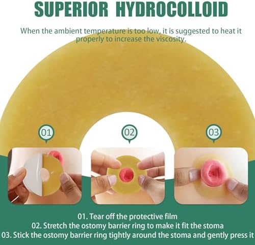 XIIFIIFII stoma barrier extenders showing the smooth texture and ideal thickness for filling deep skin contours.