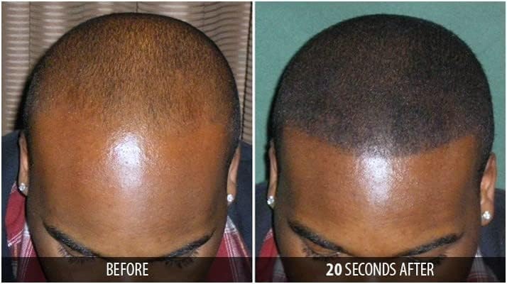Dr. Yates MD Keratin Fiber Hair Enhancer Dark Blonde complete retail bottle packaging display.