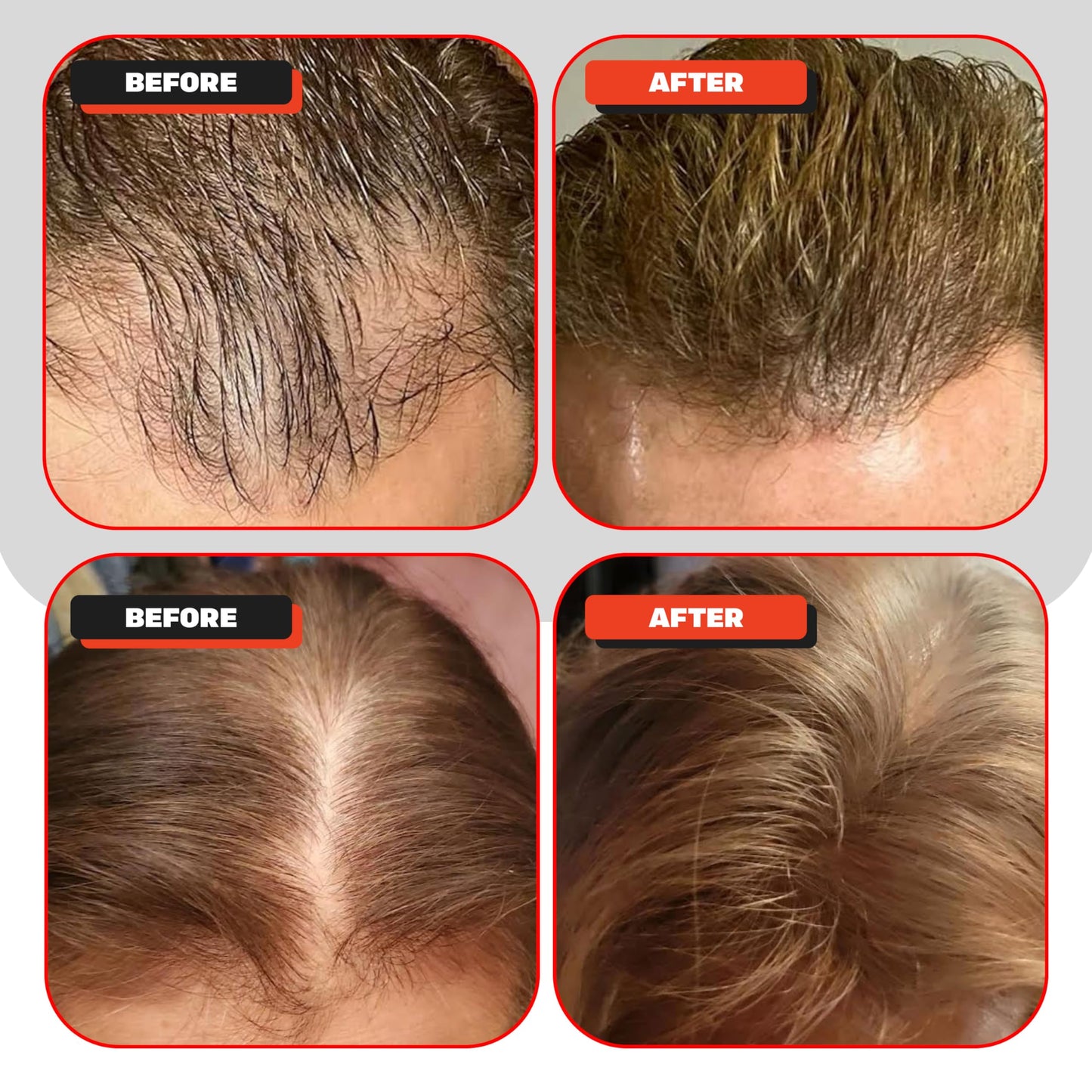Kiierr 272 Premier packaging and included hair care components