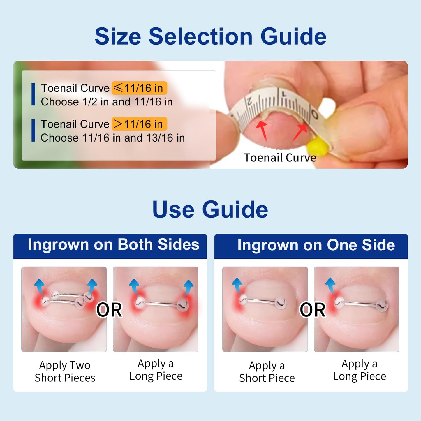 Full contents of Yanxifei ingrown toenail relief kit