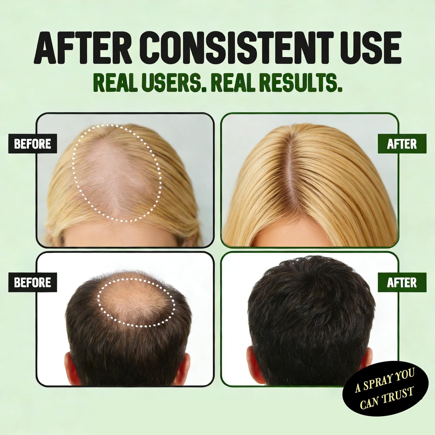 Before and after visualization of fuller hair density using LexTex treatment