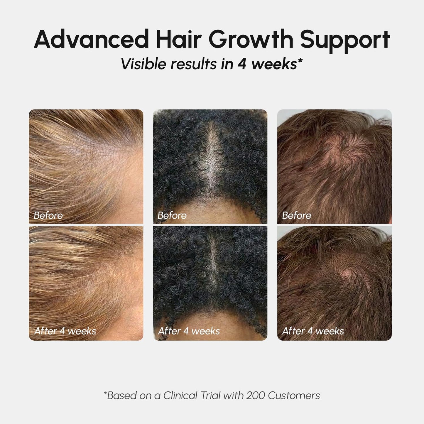 Authentic MAREE hair growth spray 65 ml packaging showcasing the professional biotin infused scalp care product.