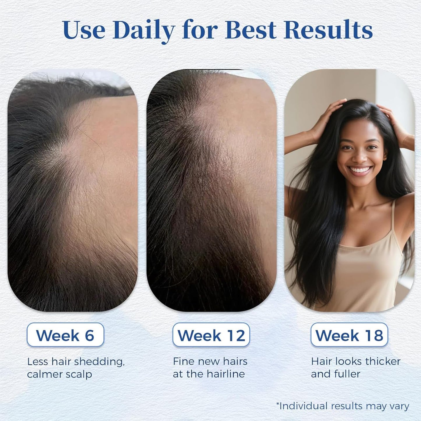 Close up view of Aparthy advanced hair serum applicator ball for targeted scalp usage