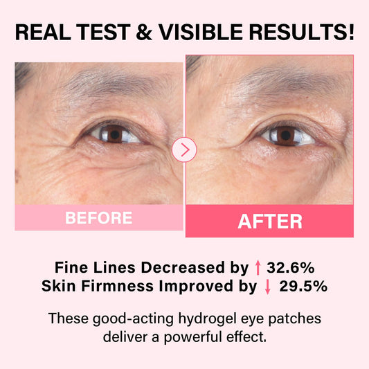 IMethod under eye mask white-to-transparent hydrogel patches displaying texture and shape details