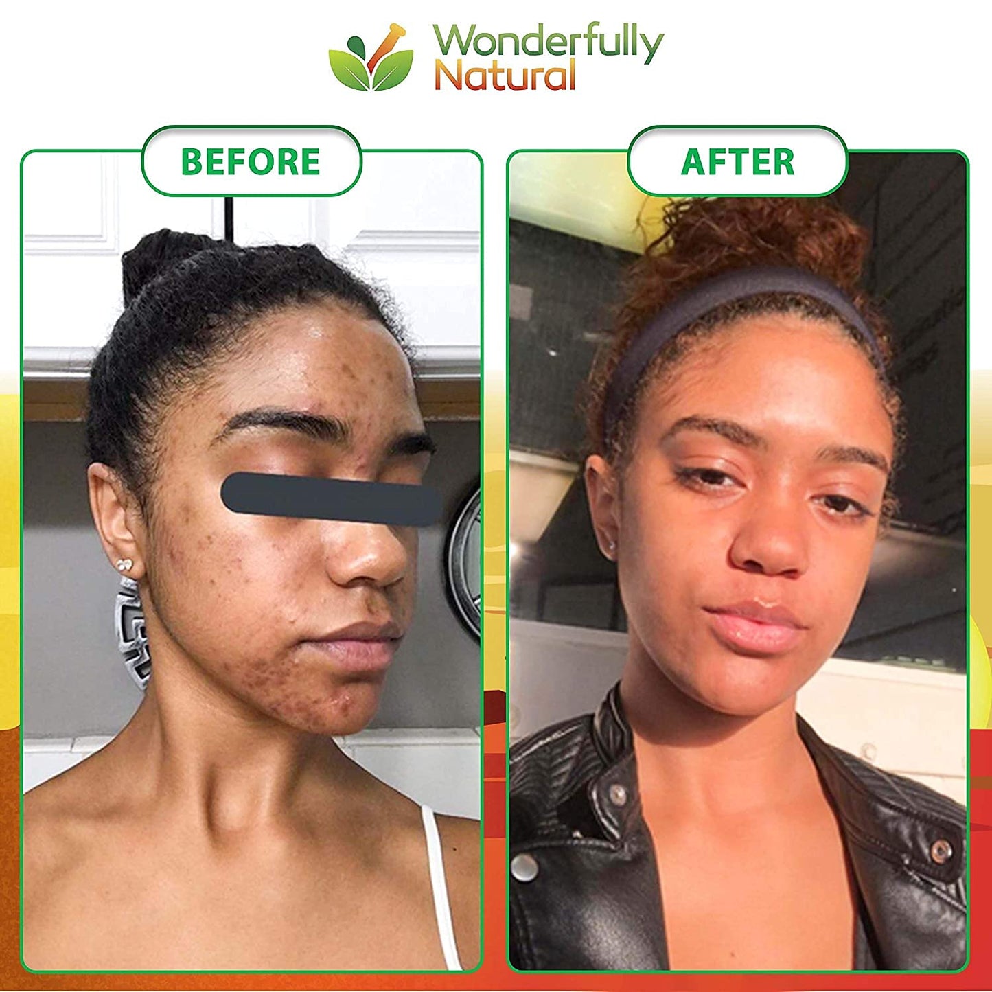 Imported Wonderfully Natural acne treatment soap block showing natural ingredients