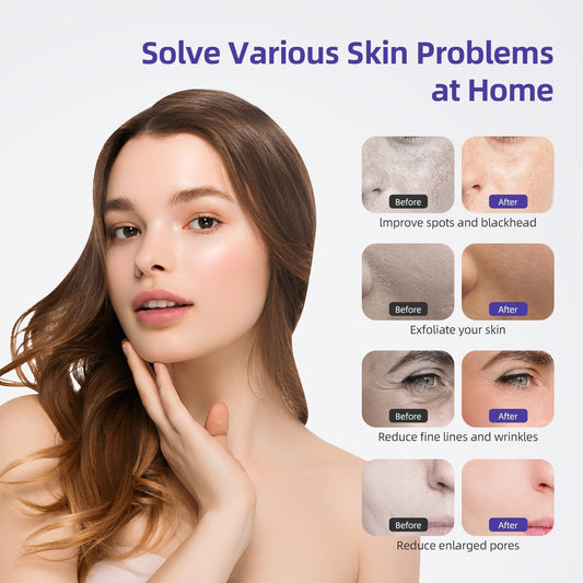 Three in one facial dermabrasion device with vacuum wands and spray bottles