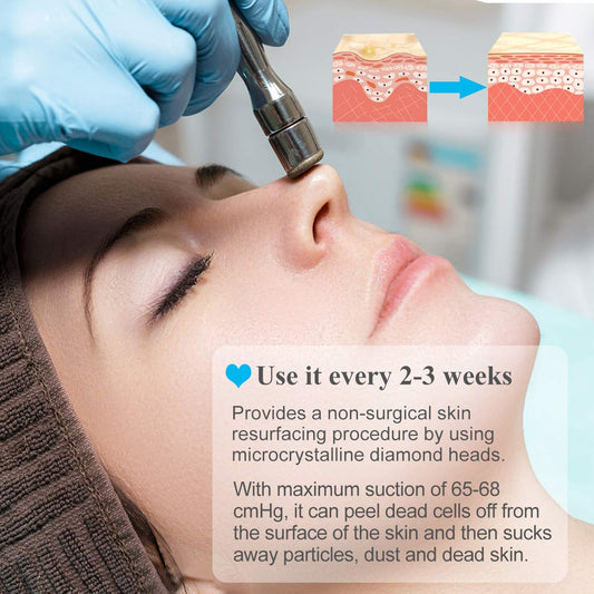 Close-up view of the Mcwdoit professional beauty device highlighting the adjustable suction control knob and internal filter system.