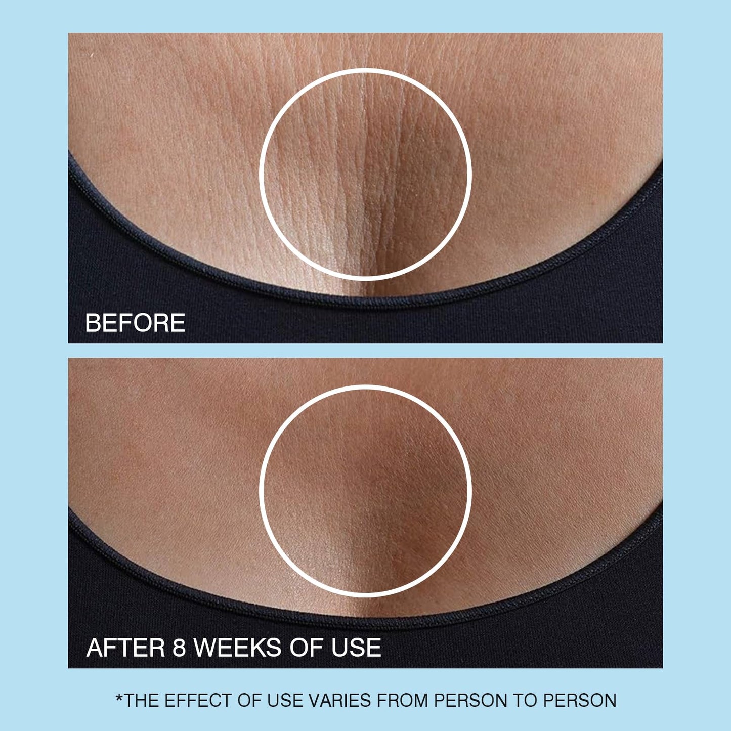 Ujhay Retinol Neck Cream skincare routine shot