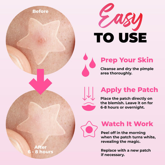 Colorful hydrocolloid blemish stickers in cloud and moon designs for clear skin