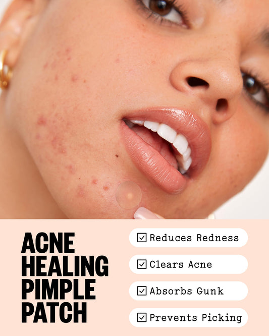 Peace Out hydrocolloid acne spot treatment dots with salicylic acid and retinol.