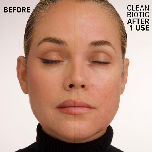 Dr. Brandt Clean Biotic yogurt cleanser bottle packaging