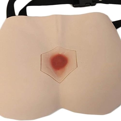 Four stages of decubitus ulcer inserts for wound care practice.