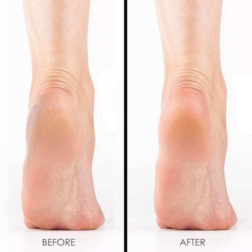 DeEnti imported foot scrapers for professional manicures and pedicures