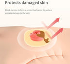 Elastic skin barrier rings for colostomy bags application preview