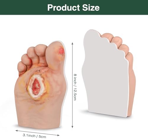 Grade 5 diabetic foot model demonstrating severe gangrene and tissue necrosis for wound care.