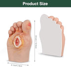 Grade 5 diabetic foot model demonstrating severe gangrene and tissue necrosis for wound care.