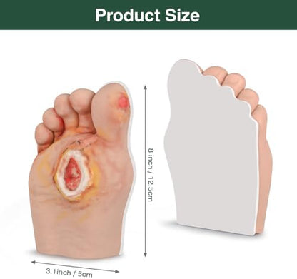 Grade 5 diabetic foot model demonstrating severe gangrene and tissue necrosis for wound care.