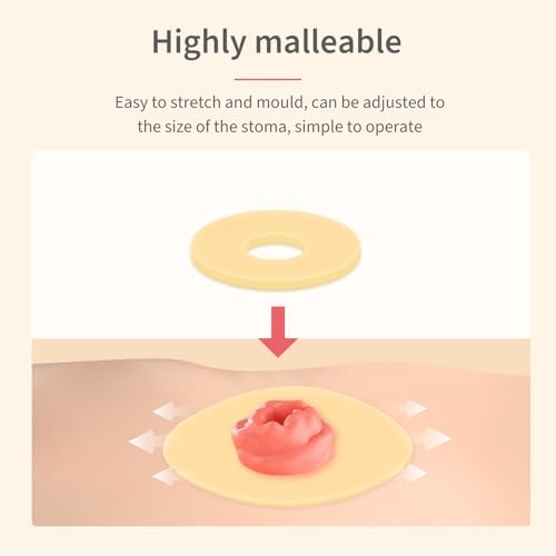 Sting free medical grade ostomy seals pack of ten overview