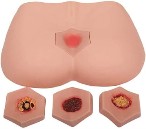 Detailed Stage 4 pressure sore model showing deep tissue damage.