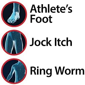 Globe Antifungal Cream tube showcasing two percent miconazole nitrate active ingredient