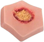 Close up of stage four necrotic ulcer on LUCKFY medical model.