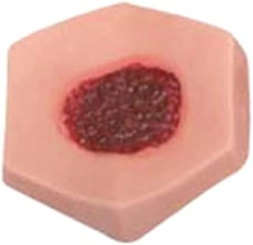 LUCKFY medical student wound care kit with interchangeable ulcer stages.
