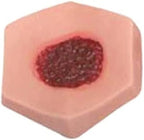 LUCKFY medical student wound care kit with interchangeable ulcer stages.