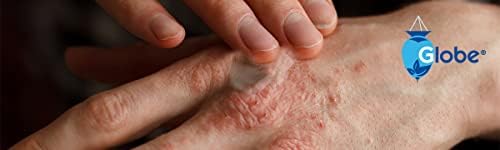 Globe brand first aid ointment for soothing rashes and skin inflammation.