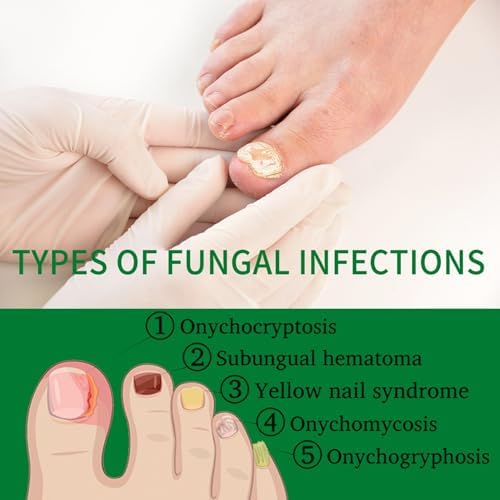 Turmeric infused nail oil providing assistance with strengthening thin fingernails