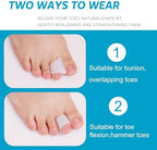 Nolimvita toe separators being worn on a foot to demonstrate alignment for bunion relief.