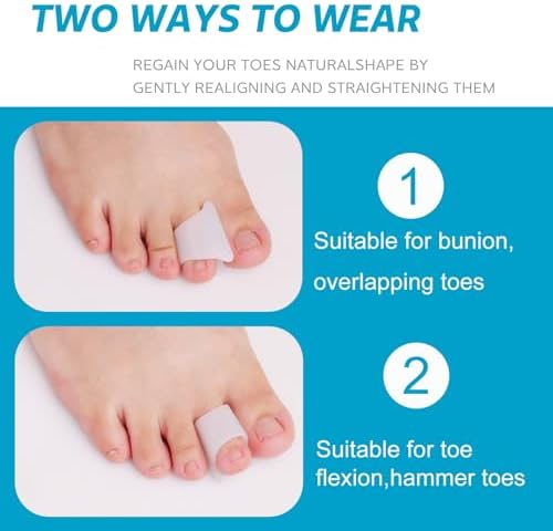 Nolimvita toe separators being worn on a foot to demonstrate alignment for bunion relief.
