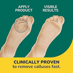 Back of packaging showing instructions for Duragel callus remover patches.