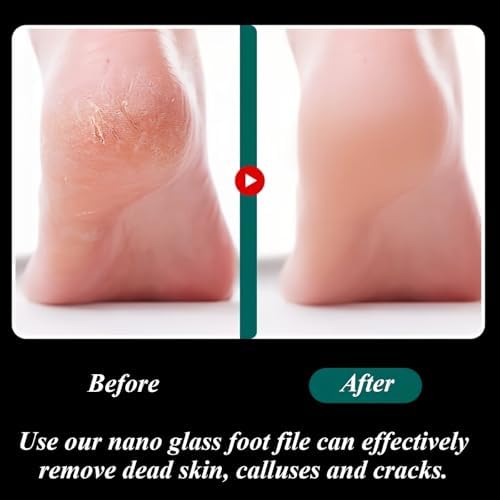 Two piece pedicure kit containing the main foot scraper and a matching glass nail file.