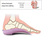 PCSsole orthotics placed inside an athletic shoe for plantar fasciitis relief