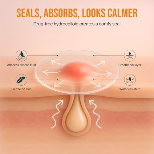 Sterile pimple patch roll applied to facial blemishes showcasing clear and discreet coverage
