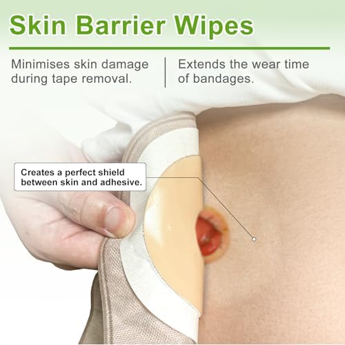 Hypoallergenic skin barrier wipes for sensitive skin protection