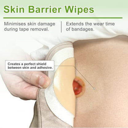 Hypoallergenic skin barrier wipes for sensitive skin protection